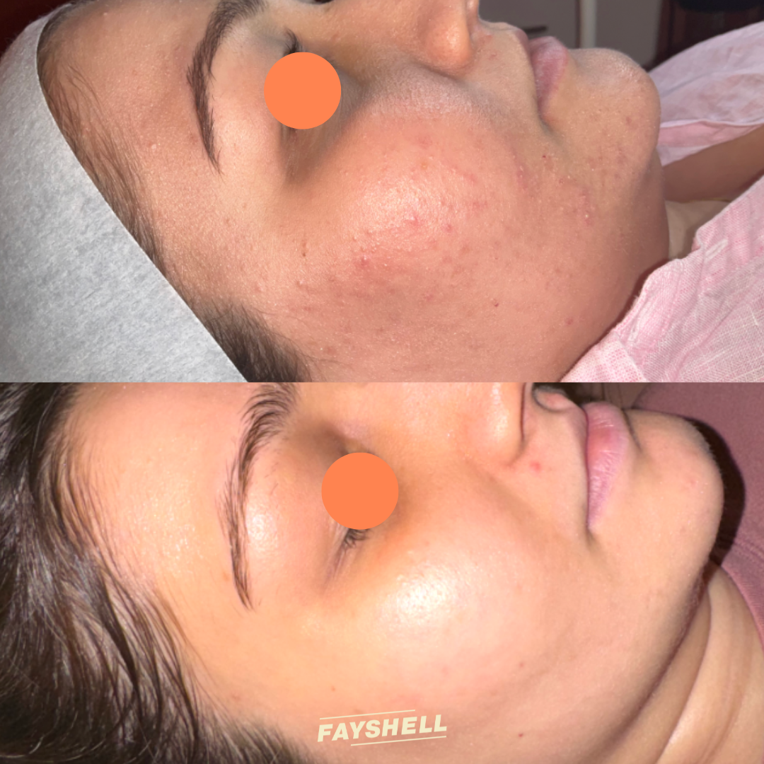 New Client Advanced Offer