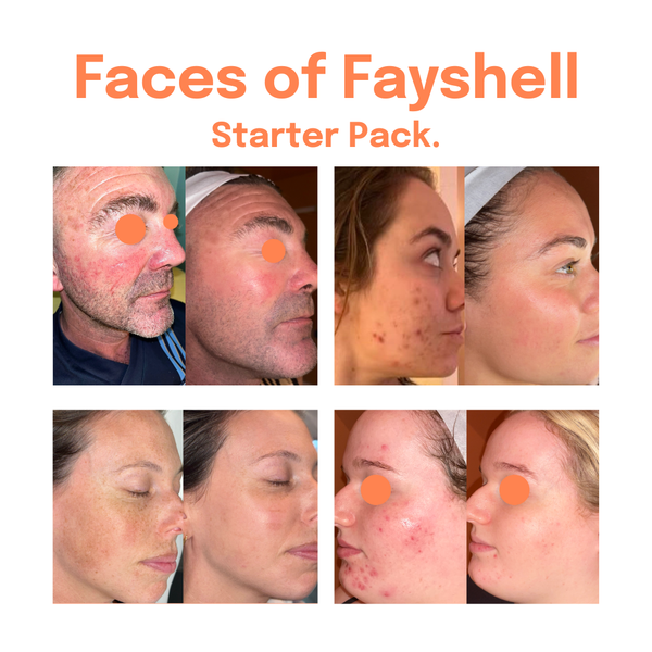 Faces of Fayshell Starter Pack