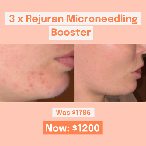 3 x Rejuran Microneedling Booster