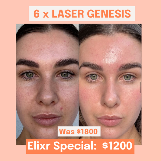 6 x Laser Genesis Pack Elixr Special