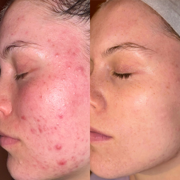 3 x The Fayshell Pack