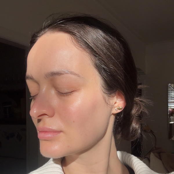 3 x Rejuran Microneedling