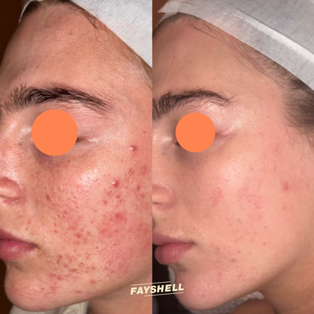 New Client Advanced Offer