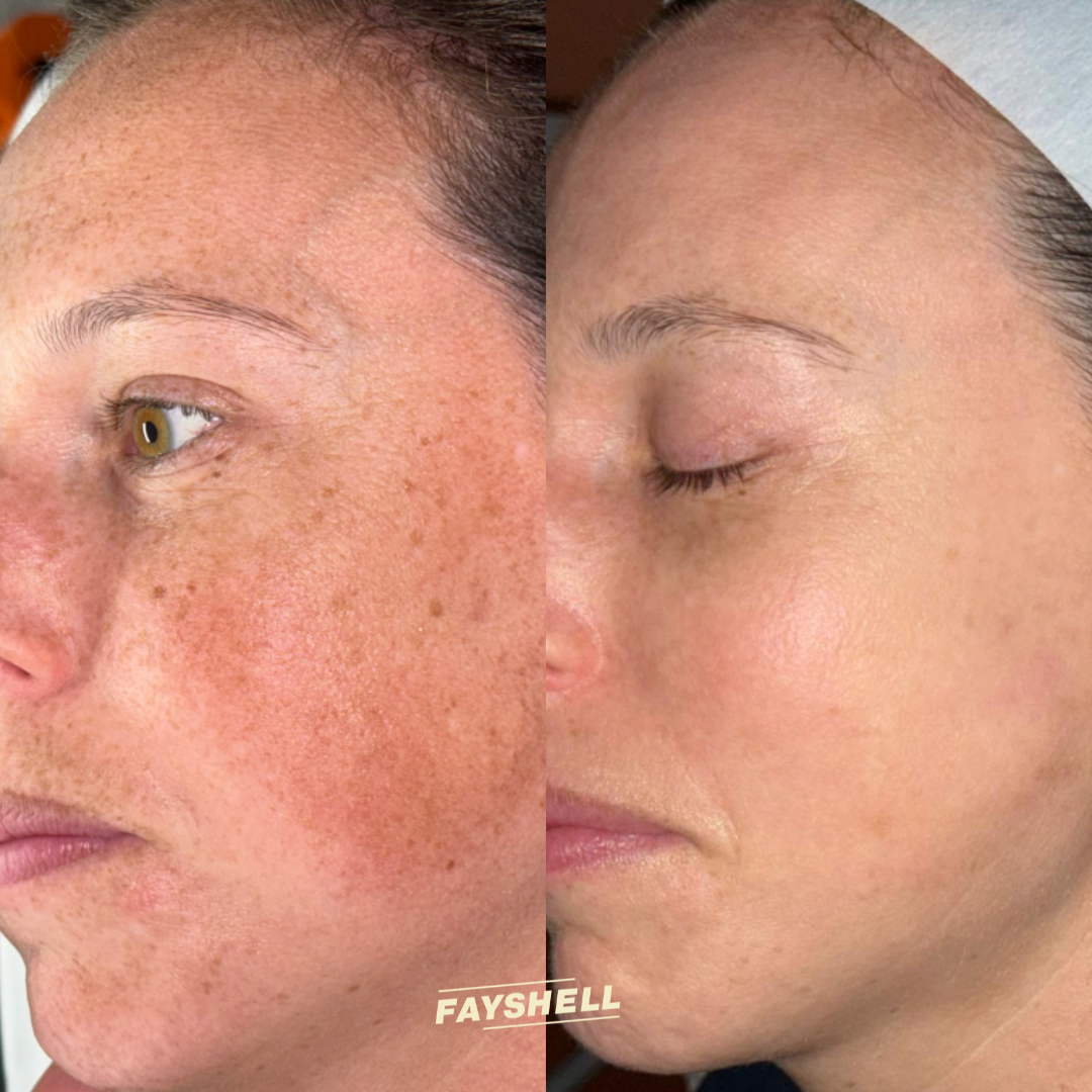 New Client Advanced Offer