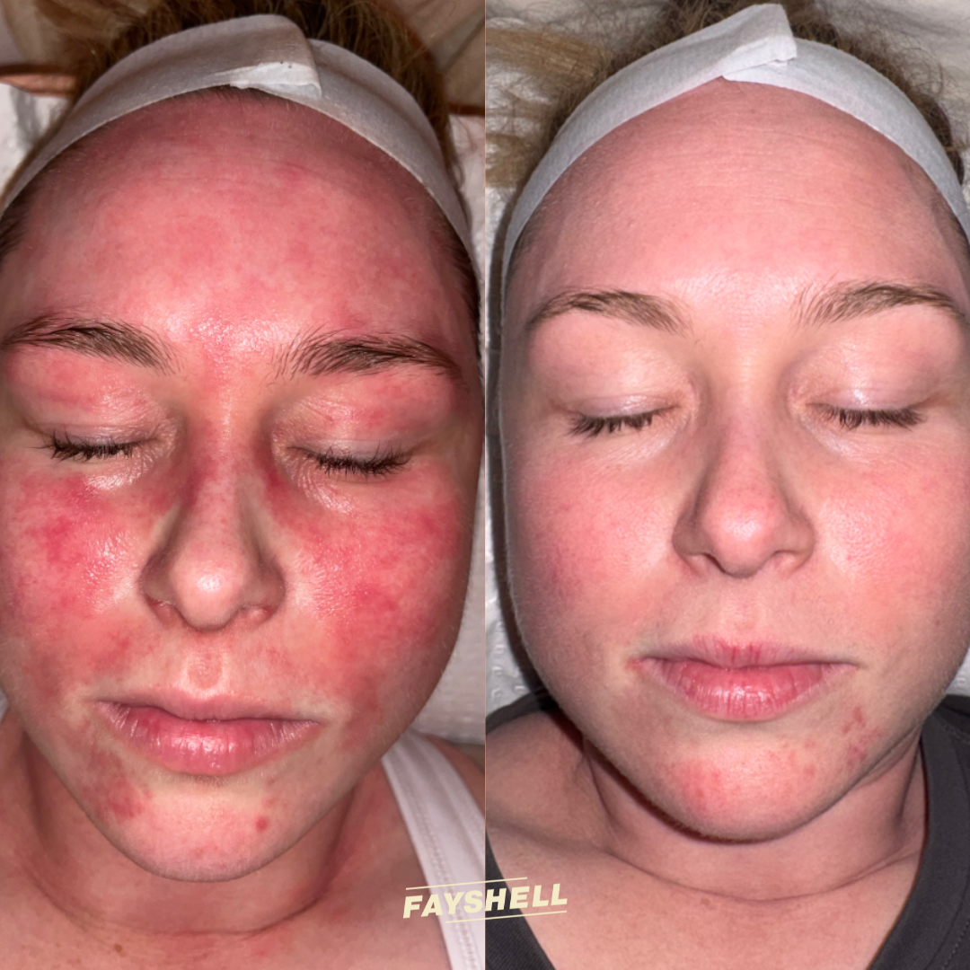 New Client Advanced Offer