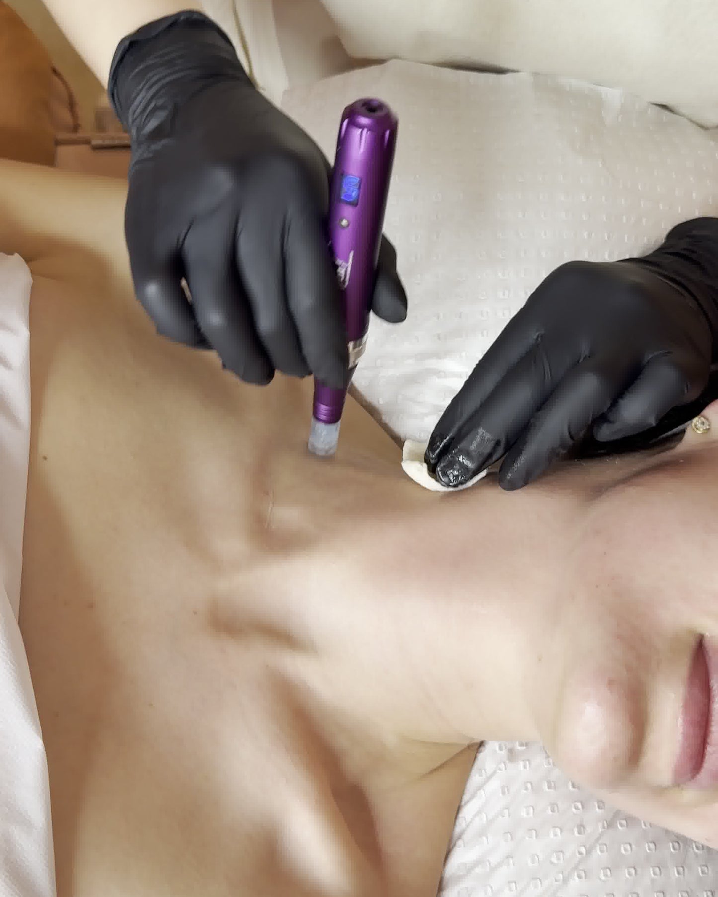 3 x Decolletage Add On